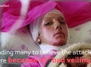 Iran Pressures Media over coverage of Acid Attacks on Women