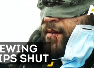 Refugees Sew Lips As Calais Jungle is Demolished (AJ+)