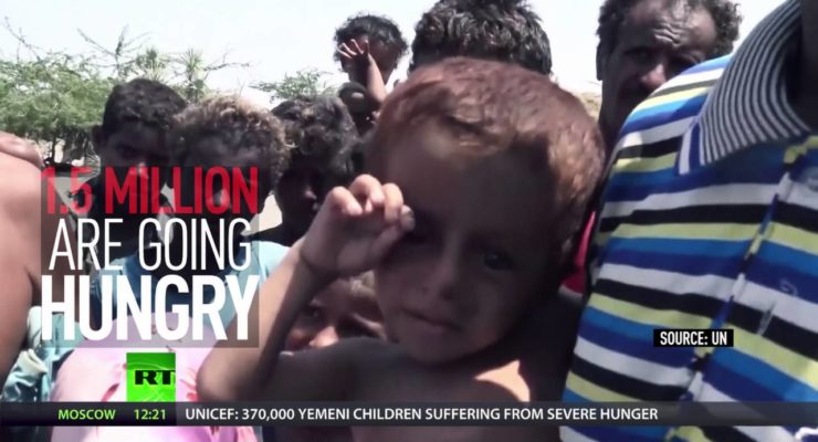 Starving Yemen