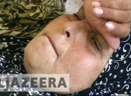 How Israel’s Blockade of Gaza Is Killing Women with Breast Cancer