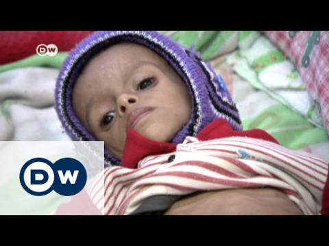 Under Saudi Bombardment, 33% of Yemenis Food Insecure