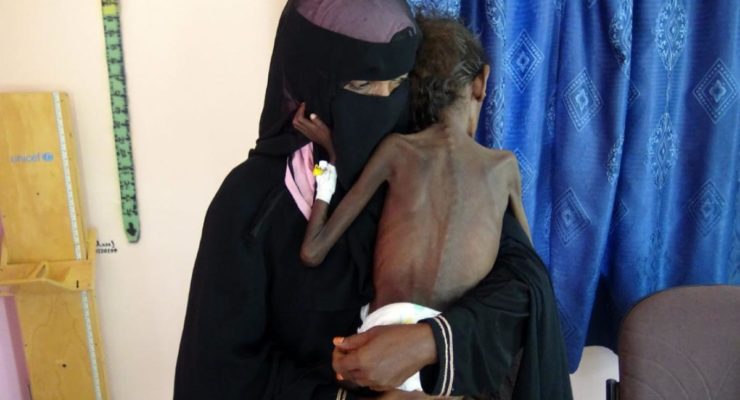 Yemeni Mothers forced to Choose Which Child Starves: Aid Group
