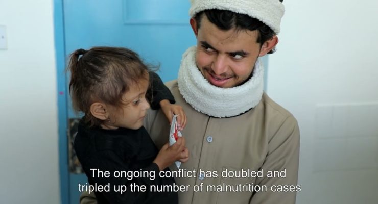 Yemen: Ukraine War, boosting Wheat Prices, has increased Food Insecurity and Acute Malnutrition for Children
